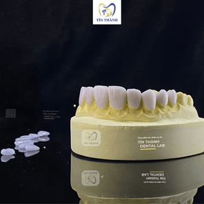 Răng Sứ CAD/CAM Emax
